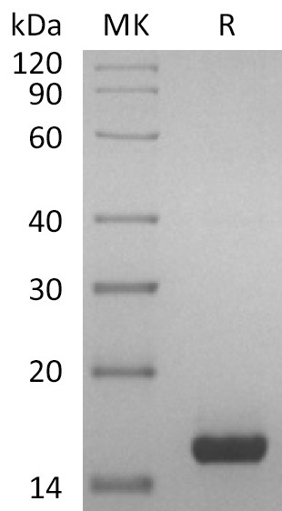 Human CST4 +SDS-PAGE.jpg